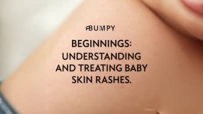 Skin Rashes